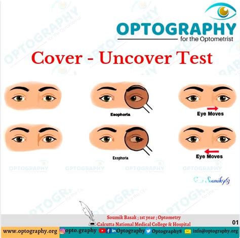 Optography - A cover test or cover-uncover test is an...