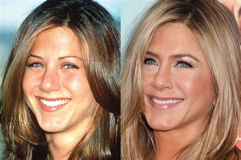 Has Jennifer Aniston Had Cosmetic Surgery?