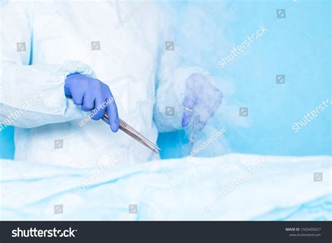 146 Cryosurgery Images, Stock Photos & Vectors | Shutterstock