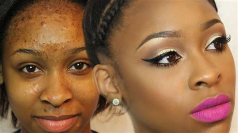 How To Cover Up Your Acne And Spots With Makeup | FabWoman