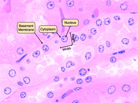 Stratified Squamous Epithelium Slide Labeled