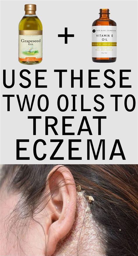 #eczema #scalp #vitaminE #grapeseedoil apply these two oils available ...