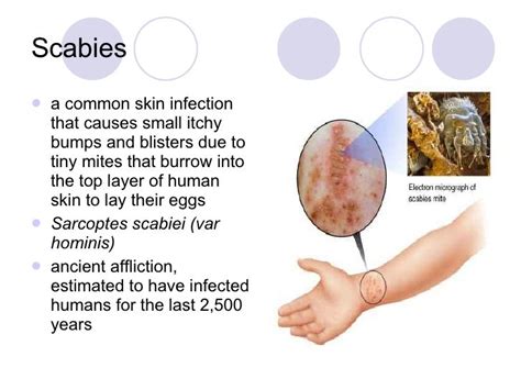 What Causes Scabies Rash