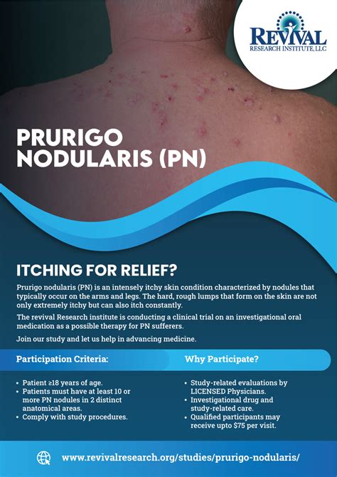 Prurigo Nodularis Clinical Trials