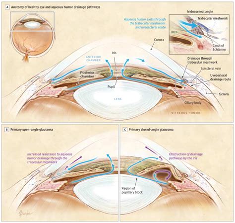 Non-Traumatic Monocular Vision Loss – Core EM