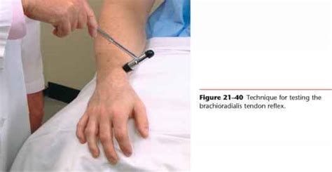 Test the Biceps Tendon Reflex - Physical Diagnosis - Mitch Medical