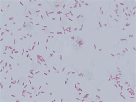 Lab Final: Gram Stain INCLUDES ALL 12 BACTERIA - Microbiology 2480 with ...