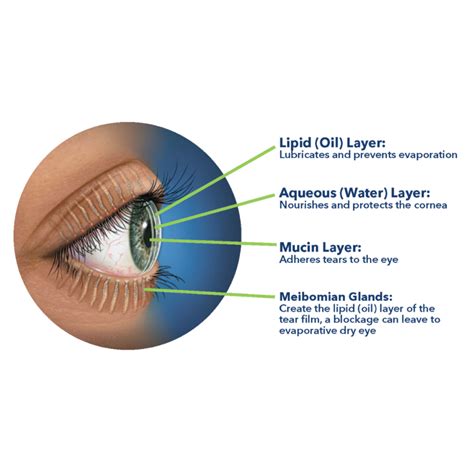 Dry Eye Disease - Redmond Eye Clinic