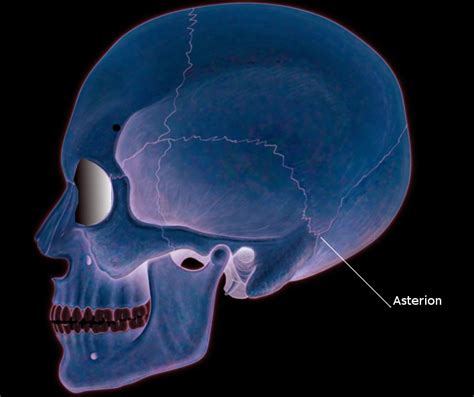 Asterion Skull