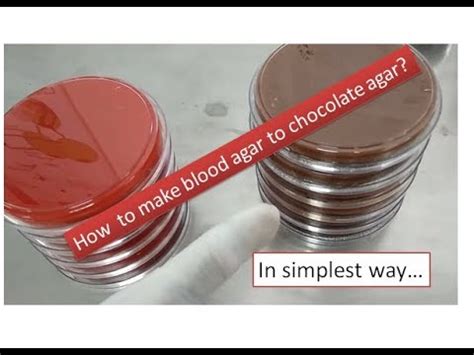 Chocolate agar preparation |simplest way | Microbiology - YouTube