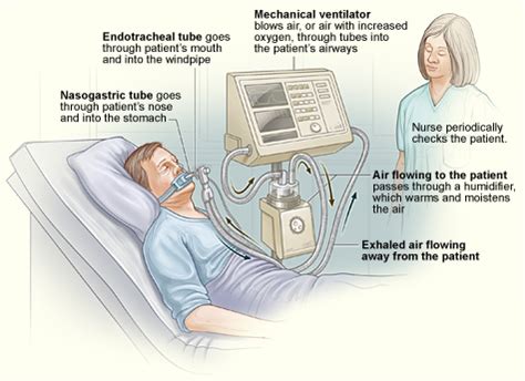 Respiratory Therapy Cave: What is a ventilator?