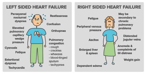 HEART FAILURE