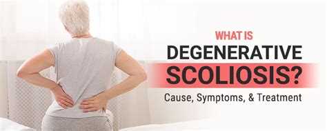 What Is Degenerative Scoliosis? Cause, Symptoms, & Treatment