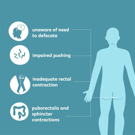 Pelvic Floor Dyssynergia Types | Review Home Co