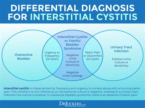 Interstitial Cystitis: Symptoms, Causes and Support Strategies