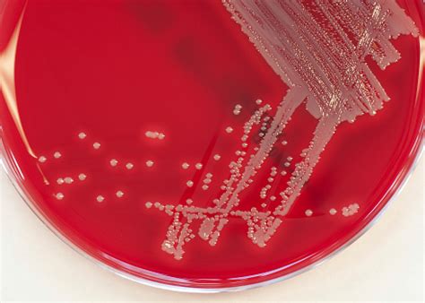 Culture Of Staphylococcus Aureus Stock Photo - Download Image Now - iStock