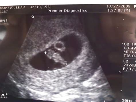 Michael Angelo, my junebug: First Ultrasound! 7 weeks pregnant!