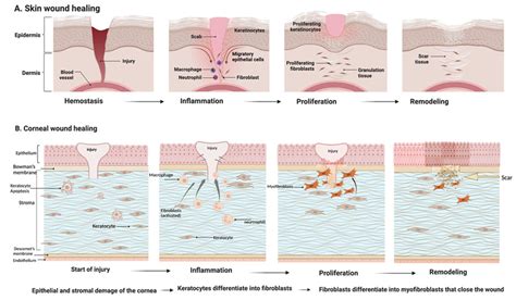 The Wound healing process. Wound healing is an important physiological ...