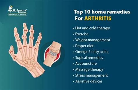 Top 10 Home Remedies for Arthritis