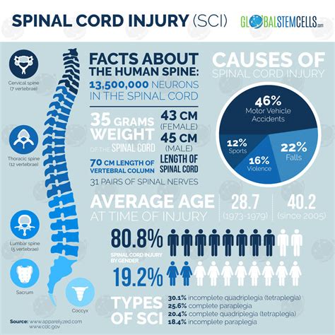 Spinal Cord Injury Patient Positive that Stem Cell is the Right Choice ...