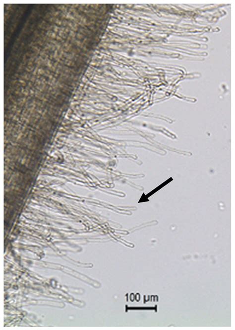 Root hair cells (black arrow pointing at one of the root hair cells ...