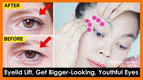 Eyelids Sagging Exercises & Massage to Get Bigger Looking, Youthful ...