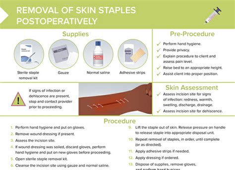 How to Remove Surgical Staples [+ Free Cheat Sheet] | Lecturio