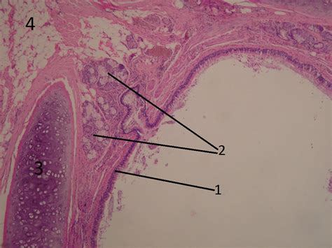 Bronchus (histology) - WikiLectures