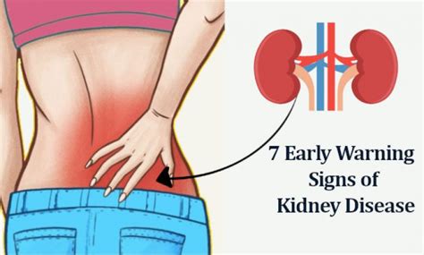 7 Early Warning Signs of Kidney Disease and 11 Foods to Avoid