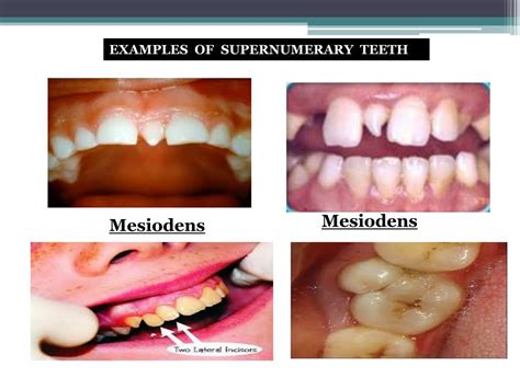 PPT - ORAL TISSUES IN HEALTH AND DISEASE PowerPoint Presentation, free ...