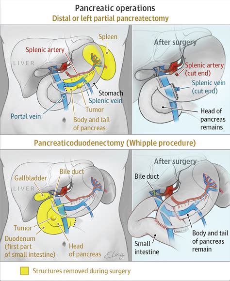 Pin on Patient Information Pages