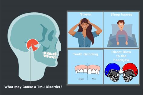 TMJ Pain Solutions - Minnesota Head & Neck Pain Clinic