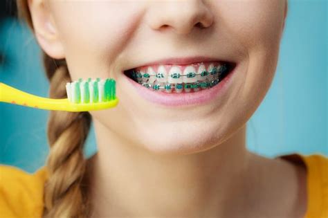 How to Brush Your Teeth with Braces - Duff Family Dental