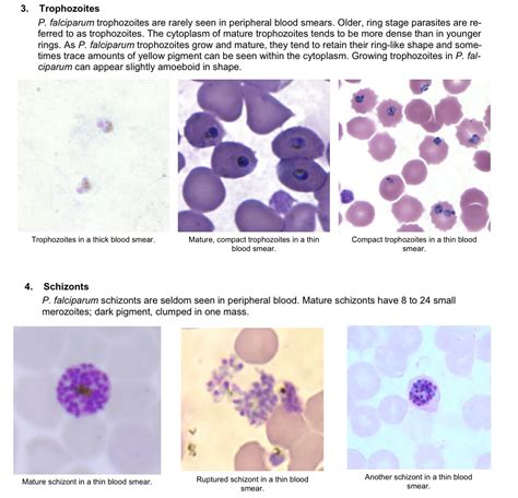 The Life Cycle of Plasmodium Falciparum | Plasmodium Falciparum