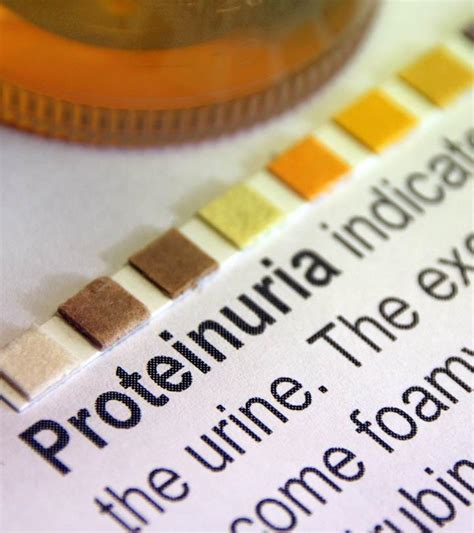 Proteinuria In Children: Causes, Symptoms, Risks & Treatment