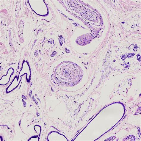 1pcs Pacinian corpuscle section from human palm skin, H.E. Stained