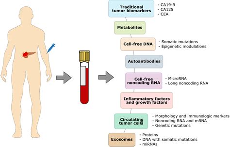 Figure 1 from Circulating biomarkers for early diagnosis of pancreatic ...