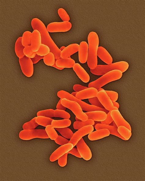 New Mycobacterium tuberculosis Study Offers Novel Paradigm for ...