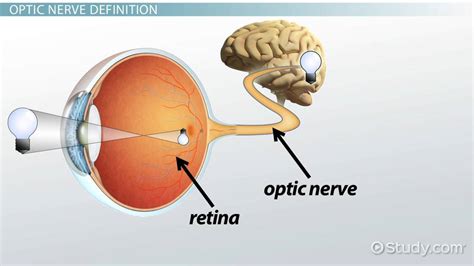 Optic Nerve Damage | Overview, Symptoms & Treatment - Video & Lesson ...