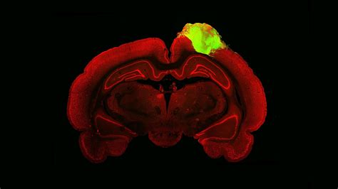 Human mini brains illuminate path to curing blindness