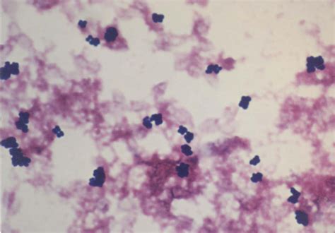 Staphylococcus Epidermidis Gram Stain