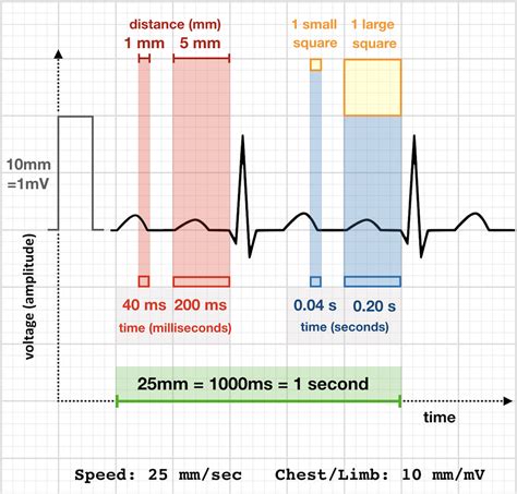 ECG Rate Interpretation • LITFL Medical Blog • ECG Library Basics