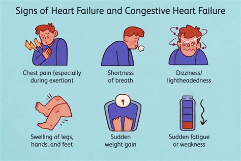 Heart Failure: Introduction and Types - Overall Science