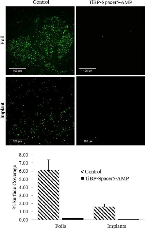 Fluorescent microscope images (Scale Bar is 100 m) of S. epidermidis ...