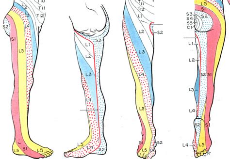 7 Causes Of Sciatica