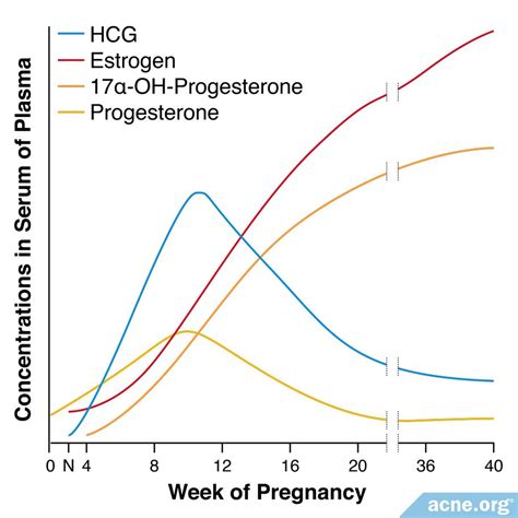 Does Pregnancy Cause Acne? - Acne.org