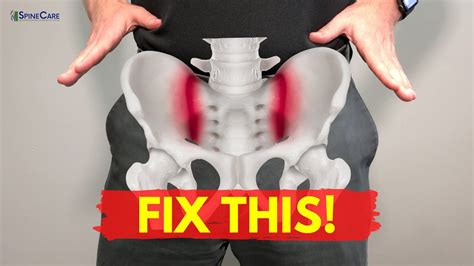 How to Fix Sacroiliac Joint Pain for Good - YouTube