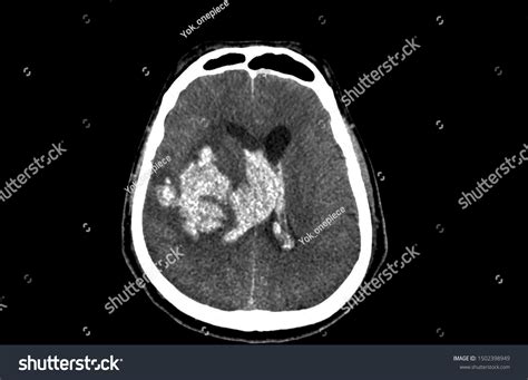 Axial View Computer Tomography Ct Scan Stock Photo 1502398949 ...