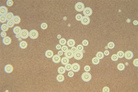 Cryptococcus neoformans - wikidoc