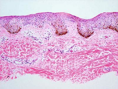 Melanocyte Histology